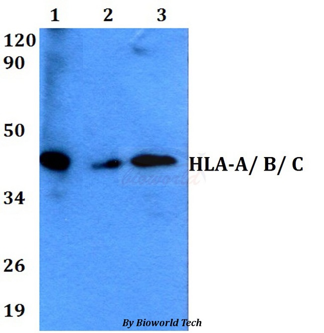 HLA-A/B/C Antibody - Western blot of HLA-A/ B/ C antibody at 1:500 dilution. Lane 1: A549 whole cell lysate. Lane 2: sp2/0 whole cell lysate. Lane 3: H9C2 whole cell lysate.