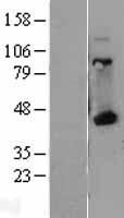 HLA-A Protein - Western validation with an anti-DDK antibody * L: Control HEK293 lysate R: Over-expression lysate