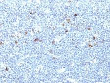 HLA-A25 + HLA-Aw32 Antibody - Formalin-fixed, paraffin-embedded human tonsil stained with HLA-Aw32 / HLA-A25 antibody (CATA-1).  This image was taken for the unmodified form of this product. Other forms have not been tested.