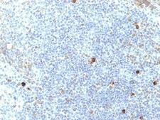 HLA-A25 + HLA-Aw32 Antibody - Formalin-fixed, paraffin-embedded human tonsil stained with HLA-Aw32 / HLA-A25 antibody (SPM417).  This image was taken for the unmodified form of this product. Other forms have not been tested.