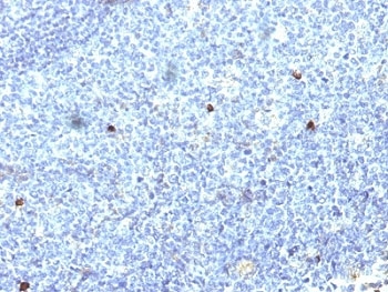 HLA-A25 + HLA-Aw32 Antibody - Formalin-fixed, paraffin-embedded human tonsil stained with HLA-Aw32 / HLA-A25 antibody (SPM418).  This image was taken for the unmodified form of this product. Other forms have not been tested.