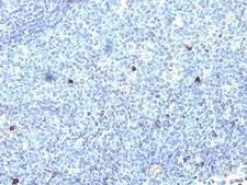 HLA-A25 + HLA-Aw32 Antibody - Formalin-fixed, paraffin-embedded human tonsil stained with HLA-Aw32 / HLA-A25 antibody (SPM418).  This image was taken for the unmodified form of this product. Other forms have not been tested.