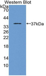 HLA-B Antibody - Western blot of recombinant HLA-B.