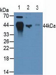 HLA-B Antibody - Western Blot; Sample: Lane1: Human Hela Cells; Lane2: Porcine Spleen Tissue; Lane3: Porcine Lymph Node Tissue.