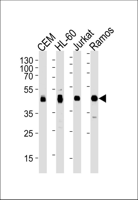 HLA-B Antibody - Western blot of lysates from CEM, HL-60, Jurkat, Ramos cell line (from left to right), using HLA-B Antibody. Antibody was diluted at 1:1000 at each lane. A goat anti-rabbit IgG H&L (HRP) at 1:5000 dilution was used as the secondary antibody. Lysates at 35ug per lane.