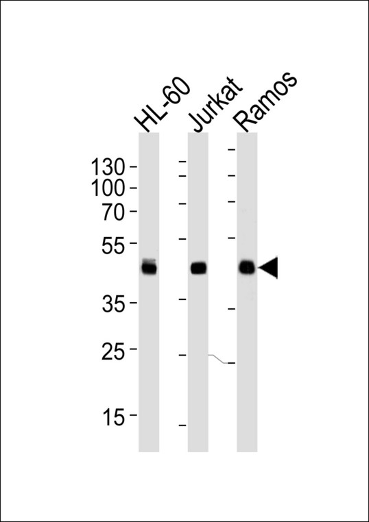 HLA-B Antibody - Western blot of lysates from HL-60, Jurkat, Ramos cell line (from left to right), using HLA-B Antibody. Antibody was diluted at 1:1000 at each lane. A goat anti-rabbit IgG H&L (HRP) at 1:5000 dilution was used as the secondary antibody. Lysates at 35ug per lane.