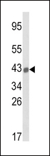 HLA-B Antibody - Western blot of HLA-B Antibody in A2058 cell line lysates (35 ug/lane). HLA-B (arrow) was detected using the purified antibody.