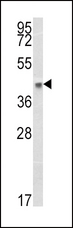 HLA-B Antibody - Western blot of HLA-B Antibody in A375 cell line lysates (35 ug/lane). HLA-B (arrow) was detected using the purified antibody.