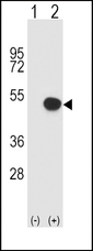 HLA-B Antibody - Western blot of HLA-B (arrow) using rabbit polyclonal HLA-B Antibody. 293 cell lysates (2 ug/lane) either nontransfected (Lane 1) or transiently transfected (Lane 2) with the HLA-B gene.