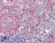 HLA-B Antibody - Anti-HLA-B antibody IHC staining of human tonsil. Immunohistochemistry of formalin-fixed, paraffin-embedded tissue after heat-induced antigen retrieval. Antibody concentration 20 ug/ml. This image was taken for the unconjugated form of this product. Other forms have not been tested.