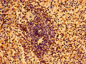HLA-B Antibody - Immunohistochemistry image of paraffin-embedded human spleen tissue at a dilution of 1:100