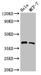 HLA-B Antibody - Positive Western Blot detected in Hela whole cell lysate, MCF-7 whole cell lysate. All lanes: HLA-B antibody at 3.2 µg/ml Secondary Goat polyclonal to rabbit IgG at 1/50000 dilution. Predicted band size: 41 KDa. Observed band size: 41 KDa