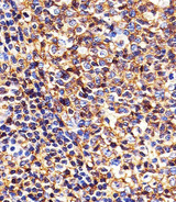 HLA-B Antibody - Immunohistochemical analysis of paraffin-embedded H. tonsil section using HLA-B Antibody (N-term). HLA-B Antibody (N-term) was diluted at 1:25 dilution. A peroxidase-conjugated goat anti-rabbit IgG at 1:400 dilution was used as the secondary antibody, followed by DAB staining.
