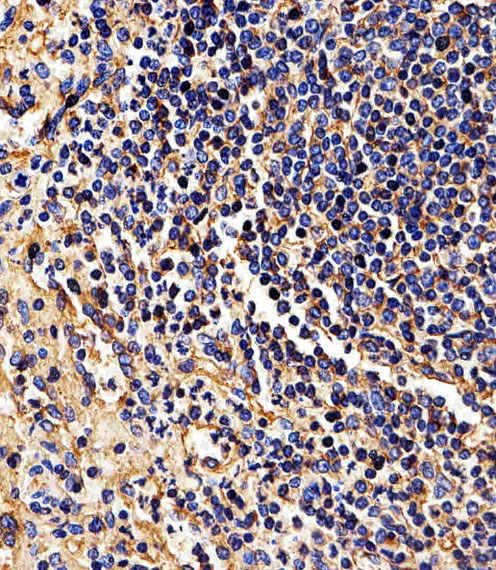 HLA-B Antibody - Immunohistochemical analysis of paraffin-embedded H. spleen section using HLA-B Antibody (N-term). HLA-B Antibody (N-term) was diluted at 1:25 dilution. A peroxidase-conjugated goat anti-rabbit IgG at 1:400 dilution was used as the secondary antibody, followed by DAB staining.