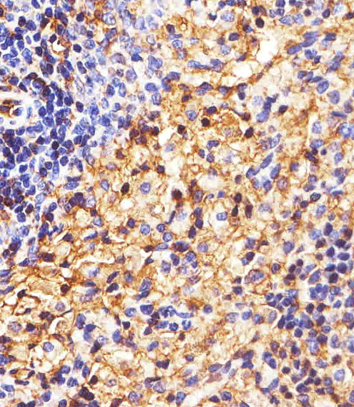 HLA-B Antibody - Immunohistochemical analysis of paraffin-embedded R. spleen section using HLA-B Antibody (N-term). HLA-B Antibody (N-term) was diluted at 1:25 dilution. A peroxidase-conjugated goat anti-rabbit IgG at 1:400 dilution was used as the secondary antibody, followed by DAB staining.