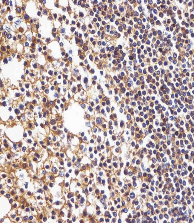 HLA-B Antibody - HLA-B Antibody (N-term) staining HLA-B in human tonsil tissue sections by Immunohistochemistry (IHC-P - paraformaldehyde-fixed, paraffin-embedded sections). Tissue was fixed with formaldehyde and blocked with 3% BSA for 0. 5 hour at room temperature; antigen retrieval was by heat mediation with a citrate buffer (pH6). Samples were incubated with primary antibody (1/25) for 1 hours at 37°C. A undiluted biotinylated goat polyvalent antibody was used as the secondary antibody.