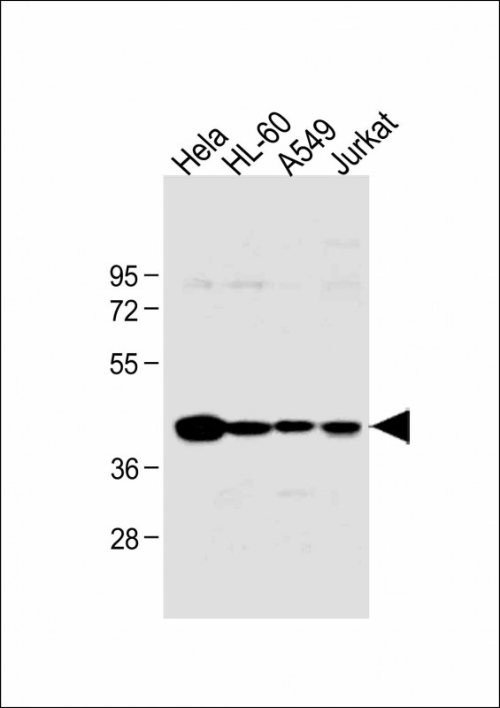 HLA-B Antibody - All lanes: Anti-HLA-B Antibody (N-term) at 1:1000 dilution Lane 1: Hela whole cell lysate Lane 2: HL-60 whole cell lysate Lane 3: A549 whole cell lysate Lane 4: Jurkat whole cell lysate Lysates/proteins at 20 µg per lane. Secondary Goat Anti-Rabbit IgG, (H+L), Peroxidase conjugated at 1/10000 dilution. Predicted band size: 40 kDa Blocking/Dilution buffer: 5% NFDM/TBST.