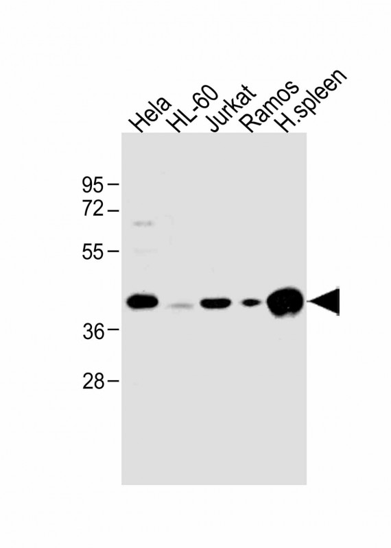 HLA-B Antibody - All lanes: Anti-HLA-B Antibody (N-term) at 1:1000 dilution Lane 1: Hela whole cell lysate Lane 2: HL-60 whole cell lysate Lane 3: Jurkat whole cell lysate Lane 4: Ramos whole cell lysate Lane 5: human spleen lysate Lysates/proteins at 20 µg per lane. Secondary Goat Anti-Rabbit IgG, (H+L), Peroxidase conjugated at 1/10000 dilution. Predicted band size: 40 kDa Blocking/Dilution buffer: 5% NFDM/TBST.