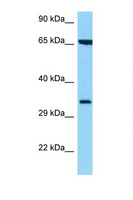 HLA-C Antibody - HLA-C antibody Western blot of 435S Cell lysate. Antibody concentration 1 ug/ml.  This image was taken for the unconjugated form of this product. Other forms have not been tested.