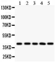 HLA-C Antibody - HLA-C antibody Western blot. All lanes: Anti HLA-C at 0.5 ug/ml. Lane 1: HELA Whole Cell Lysate at 40 ug. Lane 2: A549 Whole Cell Lysate at 40 ug. Lane 3: U87 Whole Cell Lysate at 40 ug. Lane 4: Rat Brain Tissue Lysate at 50 ug. Lane 5: Rat Liver Tissue Lysate at 50 ug. Predicted band size: 41 kD. Observed band size: 41 kD.