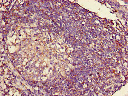 HLA-C Antibody - Immunohistochemistry of paraffin-embedded human lymph node tissue using HLA-C Antibody, Biotin conjugated at dilution of 1:100