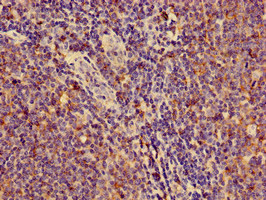 HLA-C Antibody - Immunohistochemistry of paraffin-embedded human lymph node tissue using HLA-C Antibody at dilution of 1:100