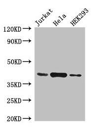 HLA-C Antibody - Western Blot Positive WB detected in: Jurkat whole cell lysate, Hela whole cell lysate, HEK293 whole cell lysate All lanes: HLA-C antibody at 4µg/ml Secondary Goat polyclonal to rabbit IgG at 1/50000 dilution Predicted band size: 41 kDa Observed band size: 41 kDa