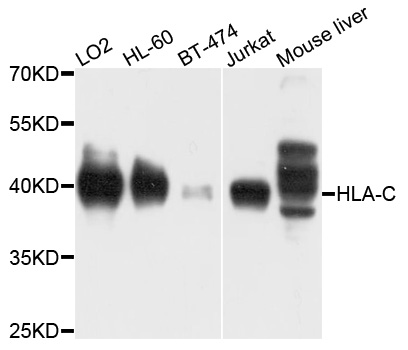 HLA-C Antibody - Western blot analysis of extracts of various cell lines, using HLA-C antibody at 1:1000 dilution. The secondary antibody used was an HRP Goat Anti-Rabbit IgG (H+L) at 1:10000 dilution. Lysates were loaded 25ug per lane and 3% nonfat dry milk in TBST was used for blocking. An ECL Kit was used for detection and the exposure time was 10s.