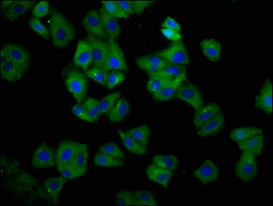 HLA Class I Histocompatibility Antigen, C-4 Alpha Chain Antibody - Immunofluorescence staining of HepG2 cells with HLA-C Antibody at 1:66, counter-stained with DAPI. The cells were fixed in 4% formaldehyde, permeabilized using 0.2% Triton X-100 and blocked in 10% normal Goat Serum. The cells were then incubated with the antibody overnight at 4°C. The secondary antibody was Alexa Fluor 488-congugated AffiniPure Goat Anti-Rabbit IgG(H+L).