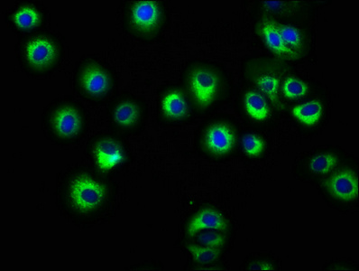 HLA Class I Histocompatibility Antigen, C-4 Alpha Chain Antibody - Immunofluorescence staining of HepG2 cells with HLA-C Antibody at 1:166, counter-stained with DAPI. The cells were fixed in 4% formaldehyde, permeabilized using 0.2% Triton X-100 and blocked in 10% normal Goat Serum. The cells were then incubated with the antibody overnight at 4°C. The secondary antibody was Alexa Fluor 488-congugated AffiniPure Goat Anti-Rabbit IgG(H+L).