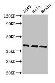 HLA Class I Histocompatibility Antigen, C-4 Alpha Chain Antibody - Western Blot Positive WB detected in: A549 whole cell lysate, Hela whole cell lysate, Mouse brain tissue All lanes: HLA-C antibody at 3.4µg/ml Secondary Goat polyclonal to rabbit IgG at 1/50000 dilution Predicted band size: 41 kDa Observed band size: 41 kDa