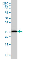 HLA-DMA Antibody - HLA-DMA monoclonal antibody (M01), clone 3F12-F11 Western blot of HLA-DMA expression in U-2 OS.