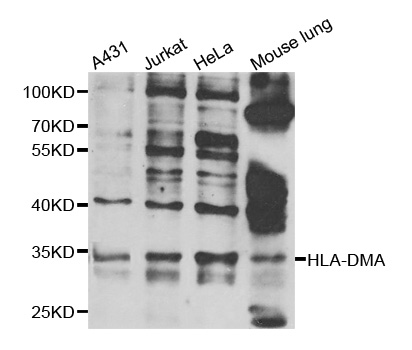 HLA-DMA Antibody - Western blot analysis of extracts of various cell lines.