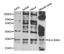 HLA-DMA Antibody - Western blot analysis of extracts of various cell lines.