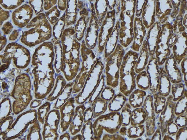 HLA-DMA Antibody - 1:100 staining rat kidney tissue by IHC-P. The sample was formaldehyde fixed and a heat mediated antigen retrieval step in citrate buffer was performed. The sample was then blocked and incubated with the antibody for 1.5 hours at 22°C. An HRP conjugated goat anti-rabbit antibody was used as the secondary.