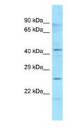 HLA-DMB Antibody - HLA-DMB antibody Western Blot of Human Placenta. Antibody dilution: 1 ug/ml.  This image was taken for the unconjugated form of this product. Other forms have not been tested.