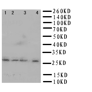 HLA-DMB Antibody - WB of HLA-DMB antibody. Lane 1: JURKAT Cell Lysate. Lane 2: JURKAT Cell Lysate. Lane 3: RAJI Cell Lysate . Lane 4: HUT Cell Lysate.