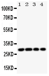 HLA-DMB Antibody - Anti-HLA DMB antibody, Western blotting All lanes: Anti HLA DMB at 0.5ug/ml Lane 1: JURKAT Whole Cell Lysate at 40ug Lane 2: JURKAT Whole Cell Lysate at 40ug Lane 3: RAJI Whole Cell Lysate at 40ug Lane 4: HUT Whole Cell Lysate at 40ug Predicted bind size: 29KD Observed bind size: 29KD