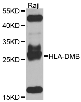 HLA-DMB Antibody - Western blot analysis of extracts of Raji cells.