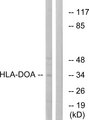 HLA-DOA Antibody - Western blot analysis of lysates from COLO cells, using HLA-DOA Antibody. The lane on the right is blocked with the synthesized peptide.