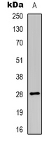 HLA-DOA Antibody - Western blot analysis of HLA-DOA expression in HL60 (A) whole cell lysates.