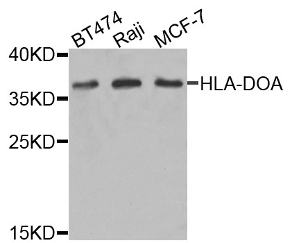 HLA-DOA Antibody - Western blot analysis of extracts of various cells.