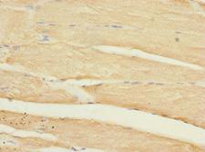 HLA-DOA Antibody - Immunohistochemistry of paraffin-embedded human skeletal muscle tissue at dilution 1:100