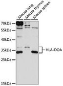 HLA-DOA Antibody - Western blot analysis of extracts of various cell lines, using HLA-DOA antibody at 1:1000 dilution. The secondary antibody used was an HRP Goat Anti-Rabbit IgG (H+L) at 1:10000 dilution. Lysates were loaded 25ug per lane and 3% nonfat dry milk in TBST was used for blocking. An ECL Kit was used for detection and the exposure time was 90S.
