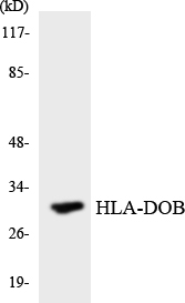 HLA-DOB Antibody - Western blot analysis of the lysates from HeLa cells using HLA-DOB antibody.