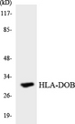 HLA-DOB Antibody - Western blot analysis of the lysates from HeLa cells using HLA-DOB antibody.