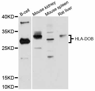 HLA-DOB Antibody - Western blot analysis of extracts of various cell lines, using HLA-DOB antibody at 1:3000 dilution. The secondary antibody used was an HRP Goat Anti-Rabbit IgG (H+L) at 1:10000 dilution. Lysates were loaded 25ug per lane and 3% nonfat dry milk in TBST was used for blocking. An ECL Kit was used for detection and the exposure time was 90s.