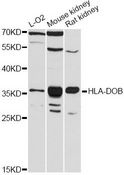 HLA-DOB Antibody - Western blot analysis of extracts of various cell lines, using HLA-DOB antibody at 1:3000 dilution. The secondary antibody used was an HRP Goat Anti-Rabbit IgG (H+L) at 1:10000 dilution. Lysates were loaded 25ug per lane and 3% nonfat dry milk in TBST was used for blocking. An ECL Kit was used for detection and the exposure time was 90s.