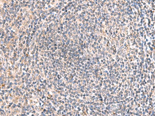 HLA-DOB Antibody - Immunohistochemistry of paraffin-embedded Human tonsil tissue  using HLA-DOB Polyclonal Antibody at dilution of 1:45(×200)