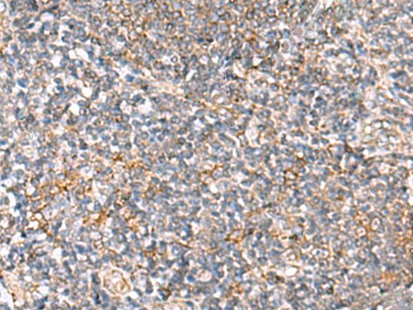 HLA-DOB Antibody - Immunohistochemistry of paraffin-embedded Human tonsil tissue  using HLA-DOB Polyclonal Antibody at dilution of 1:40(×200)